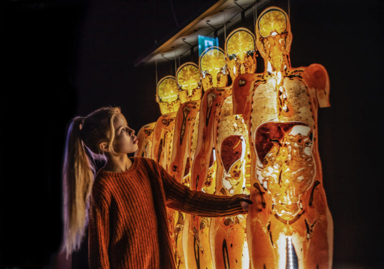 body-worlds-girl-slices-p0a0668