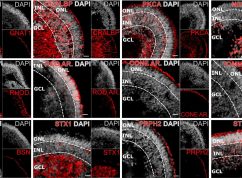 retinalniorganoidy_03